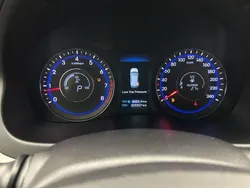 30884380